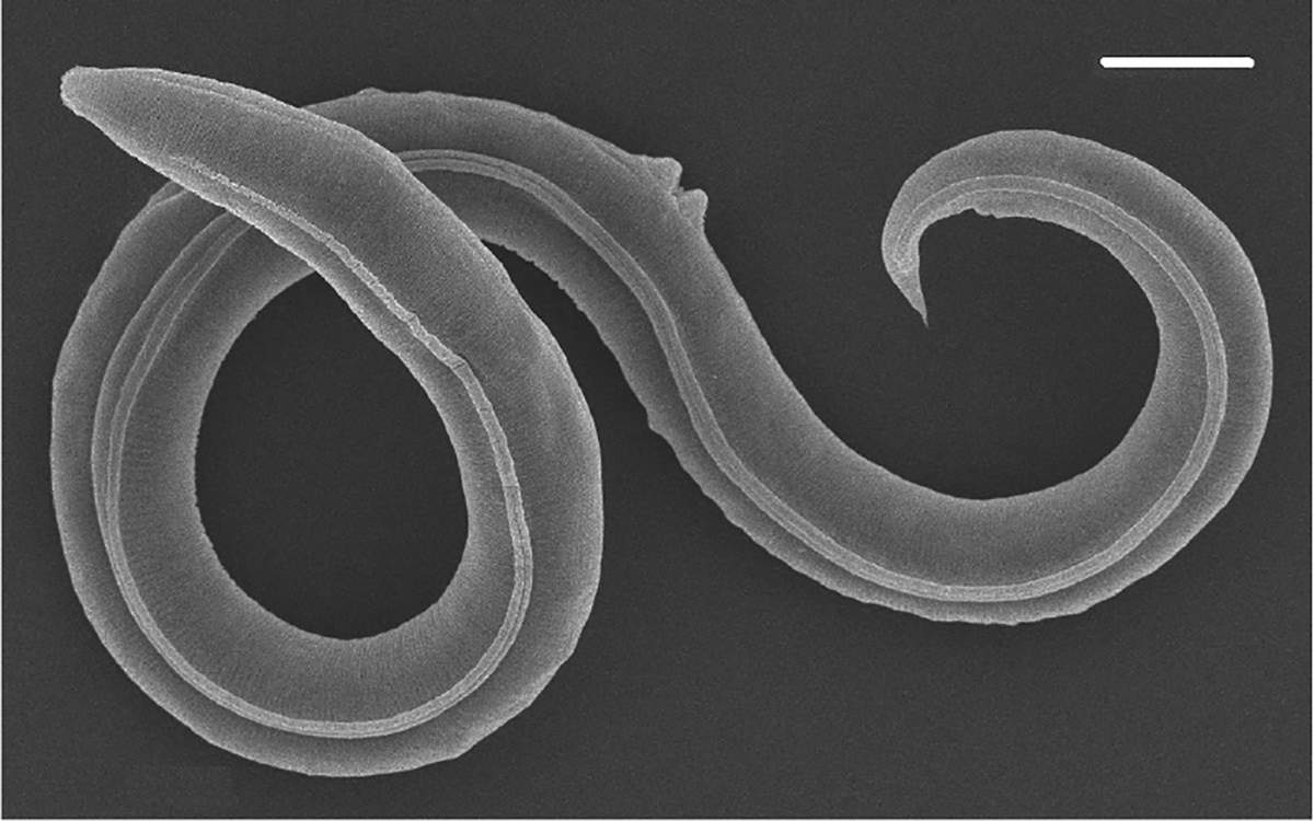 P. kolymaensis, female. Scanning electron picture.