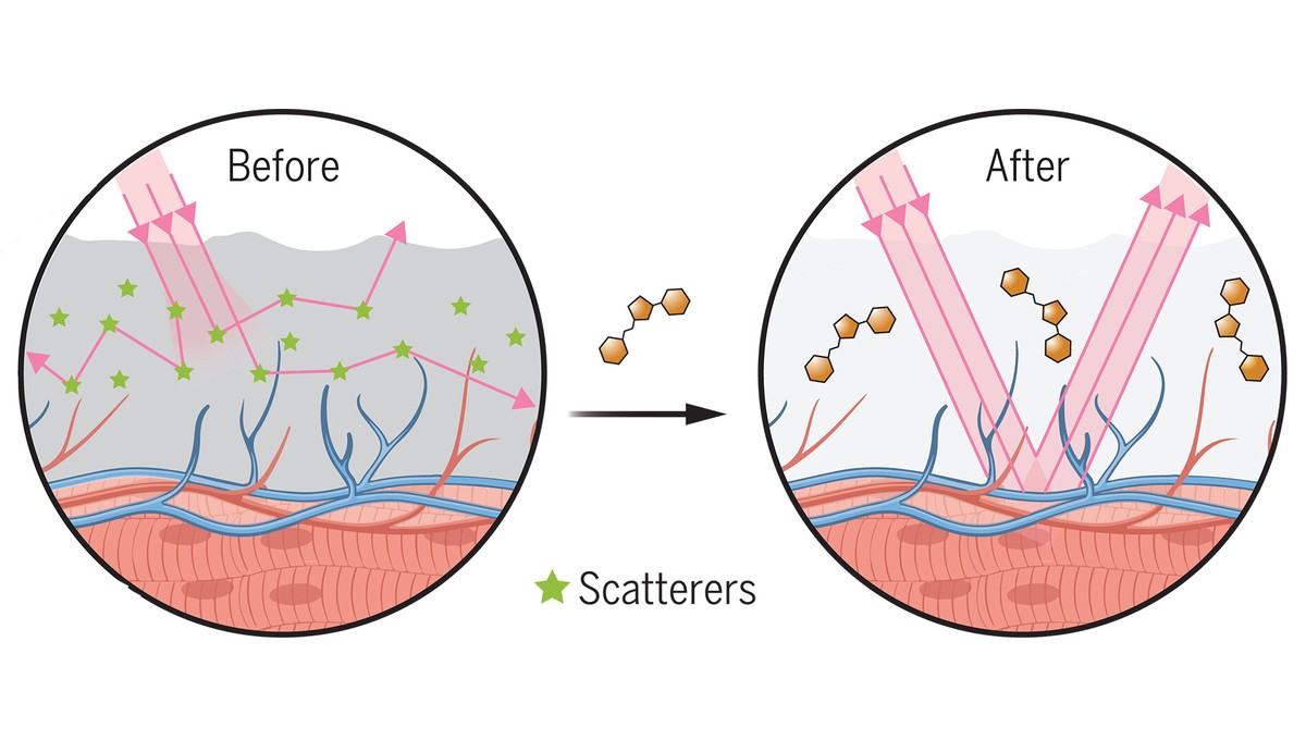 Before and after diagrams showing how light is normally scattered by skin, but passes through cleanly after the application of tartrazine.